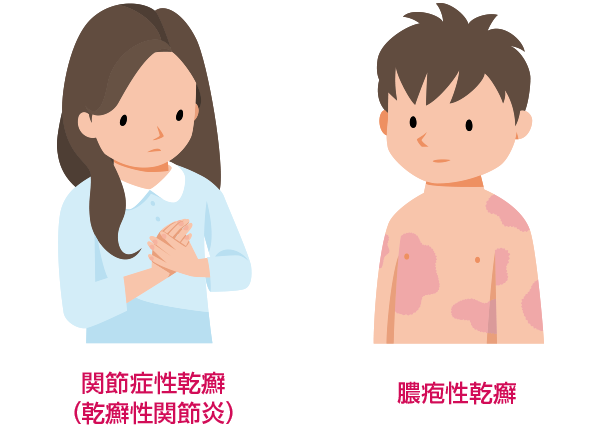 私の赤ちゃんは湿疹または乾癬を患っていますか?