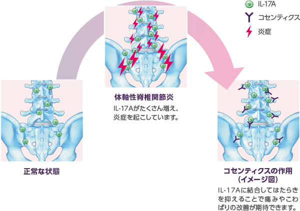 コセンティクスの作用（イメージ図）