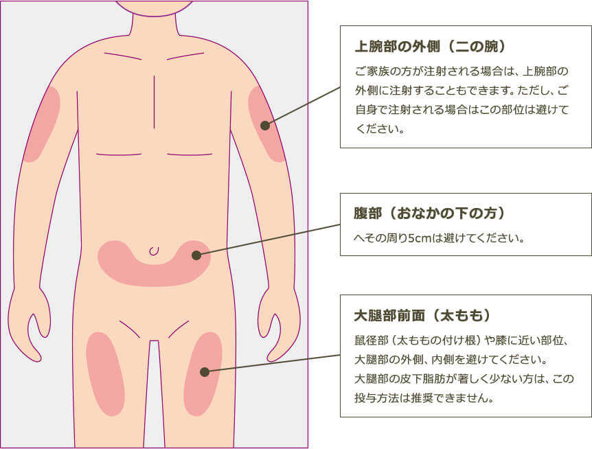 上腕部の外側（二の腕） … ご家族の方が注射される場合は、上腕部の外側に注射することもできます。ただし、ご自身で注射される場合はこの部位は避けてください。 腹部（おなかの下の方） … へその周り5cmは避けてください。 大腿部前面（太もも） … 鼠径部（太ももの付け根）や膝に近い部位、大腿部の外側、内側を避けてください。大腿部の皮下脂肪が著しく少ない方は、この投与方法は推奨できません。