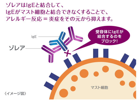 ゾレアはIgEと結合して、IgEがマスト細胞と結合できなくすることで、アレルギー反応=炎症をその元から押さえます。