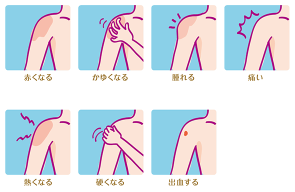 赤くなる かゆくなる 腫れる 痛い 熱くなる 硬くなる 出血する