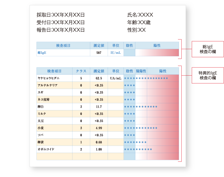 一般的なIgE検査の報告書のサンプル