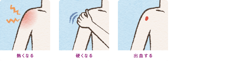 熱くなる 硬くなる 出血する