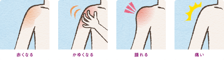 赤くなる かゆくなる 腫れる 痛い