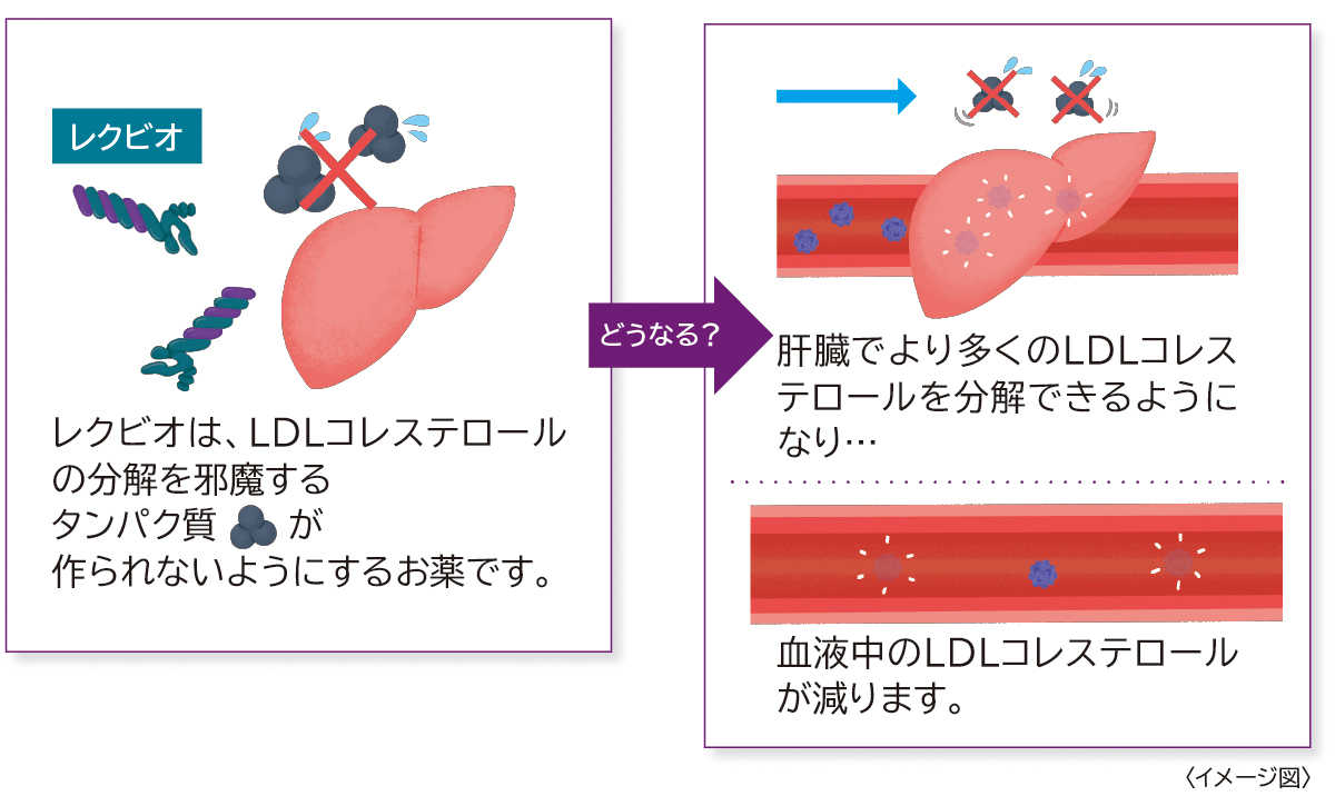 レクビオは、LDLコレステロールの分解を邪魔するタンパク質が作られないようにするお薬です。　どうなる？　肝臓でより多くのLDLコレステロールを分解できるようになり…血液中のLDLコレステロールが減ります。