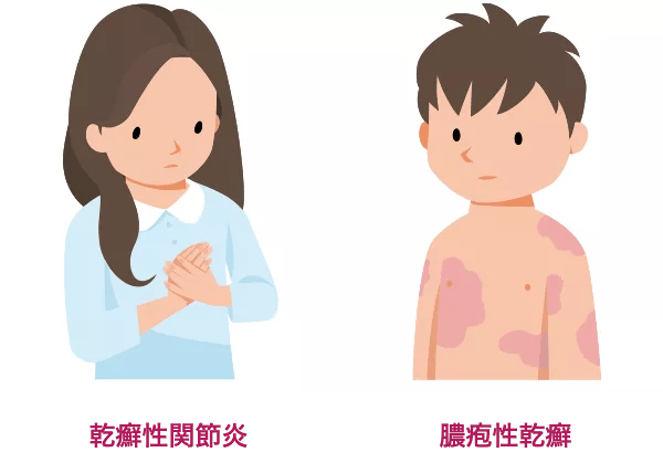 イメージ：関節症性乾癬（乾癬性関節炎）の患者さん・膿疱性乾癬（汎発型）の患者さんのイラスト