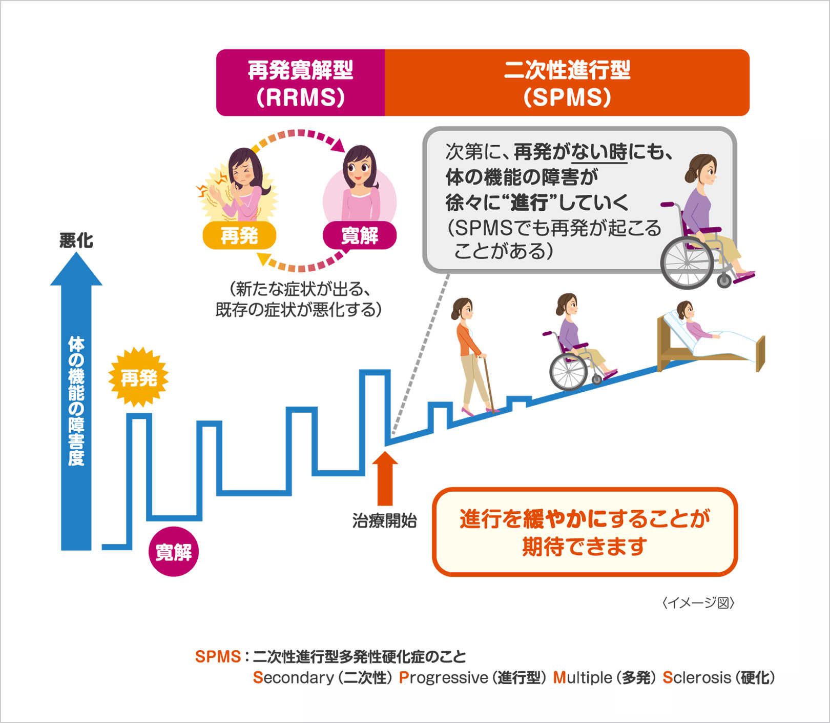 多発性硬化症と“進行”のイメージ