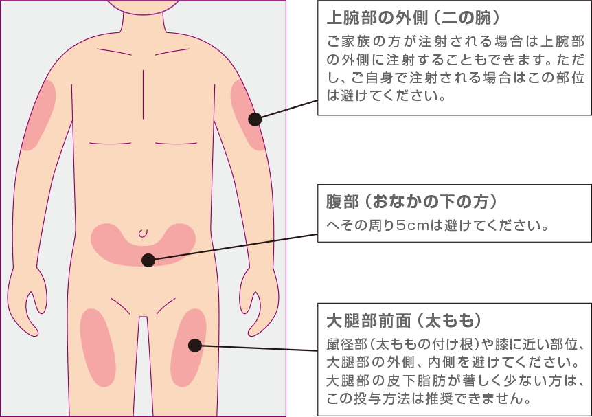 大腿部前面（太もも）鼠径部（太ももの付け根）や膝に近い部位、大腿部の外側、内側を避けてください。大腿部の皮下脂肪が著しく少ない方は、この投与方法は推奨できません。