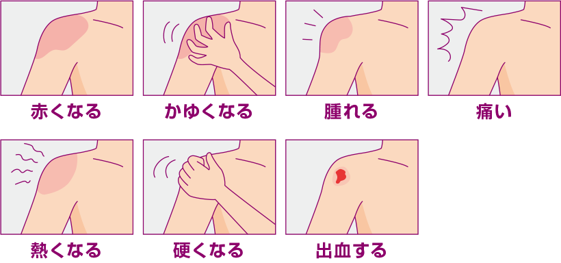 赤くなる かゆくなる 腫れる 痛い 熱くなる 硬くなる 出血する