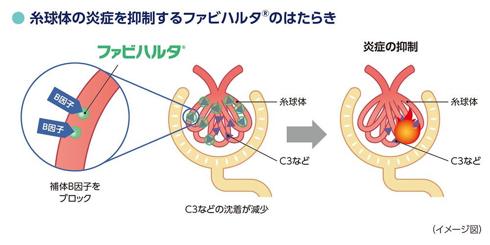 イメージ図：糸球体の炎症を抑制するファビハルタ®のはたらき