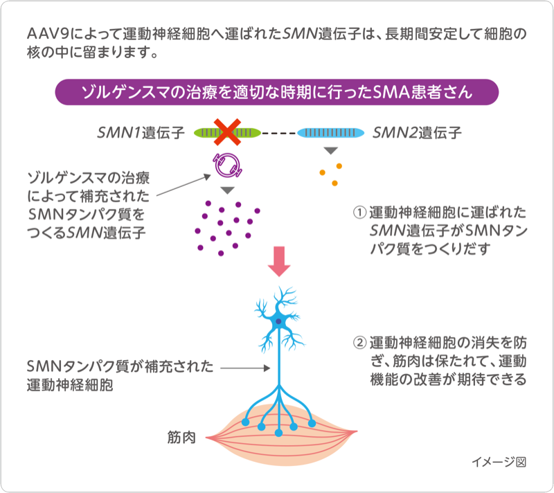 図：ゾルゲンスマの治療を適切な時期に行ったSMA患者さんの場合