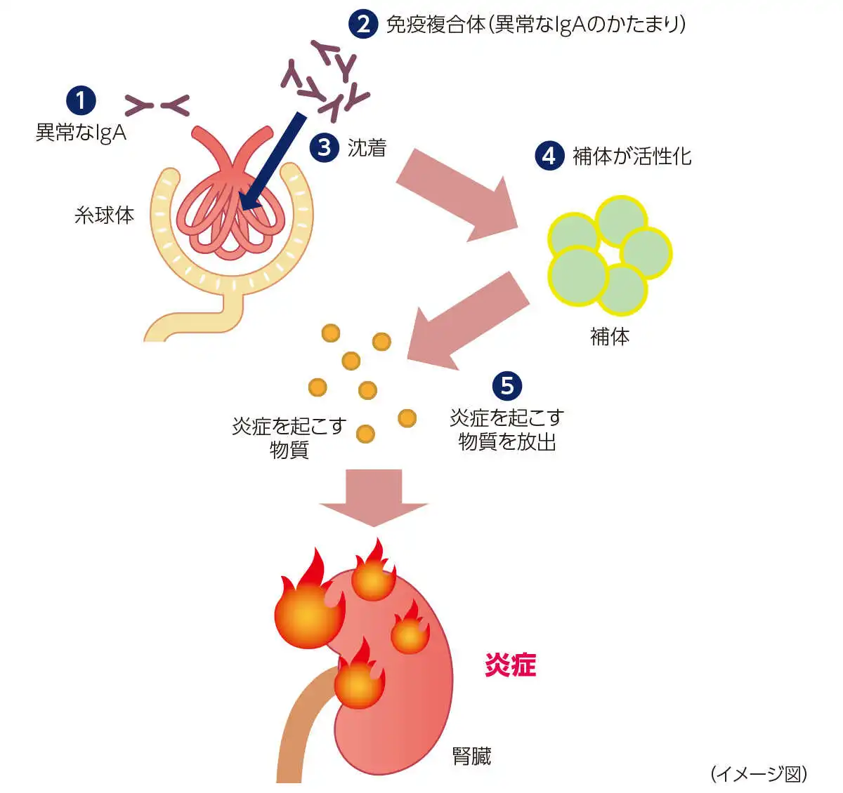 イメージ図