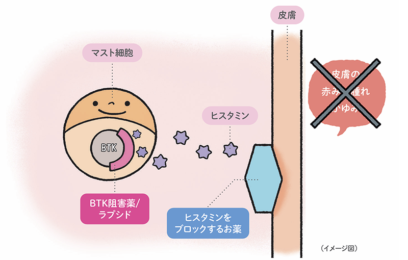 イメージ図：ラプシドはどのように慢性特発性じんましんを抑えるの？