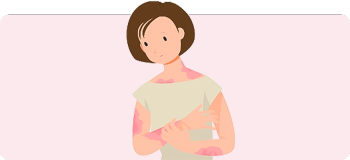 乾癬（かんせん）について