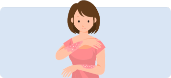 膿疱性乾癬（のうほうせいかんせん）について