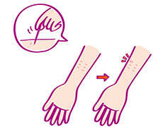 イメージ：スクラッチテストのイラスト