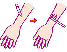 イメージ：皮肉反応のイラスト