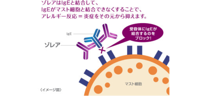 ゾレアのしくみ