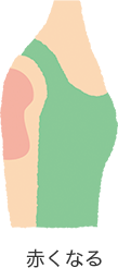 イメージ:赤くなるイラスト