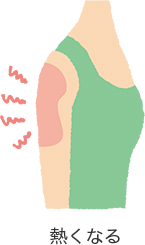 イメージ：熱くなるイラスト