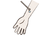 イメージ：プリックテスト