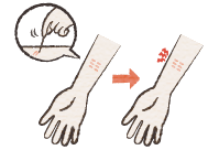 イメージ:スクラッチテスト