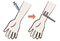 イメージ：皮内反応