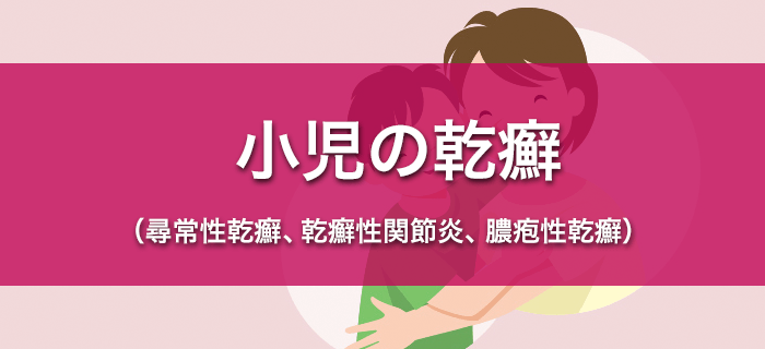 小児の乾癬