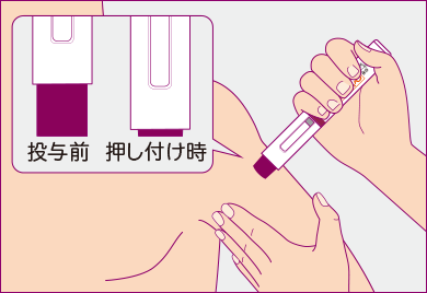 針ガードを最後まで押し込めるようにペンを押し付けます。