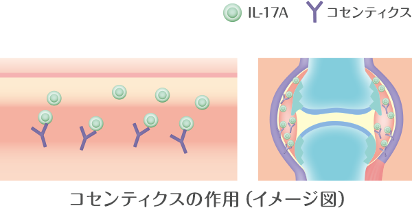 コセンティクスの作用（イメージ図）