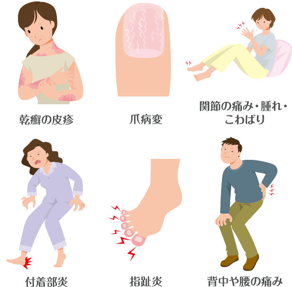 症状の確認