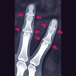 イメージ：X線検査