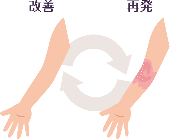 イメージ:改善と再発のイラスト