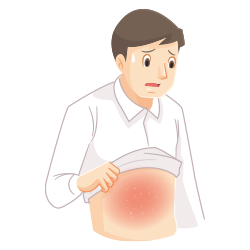 イメージ：皮膚が赤くなった男性のイラスト