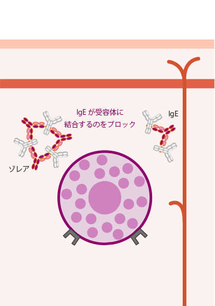 イメージ図：ゾレアによる治療