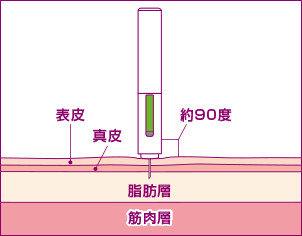 イメージ：皮下注射とは