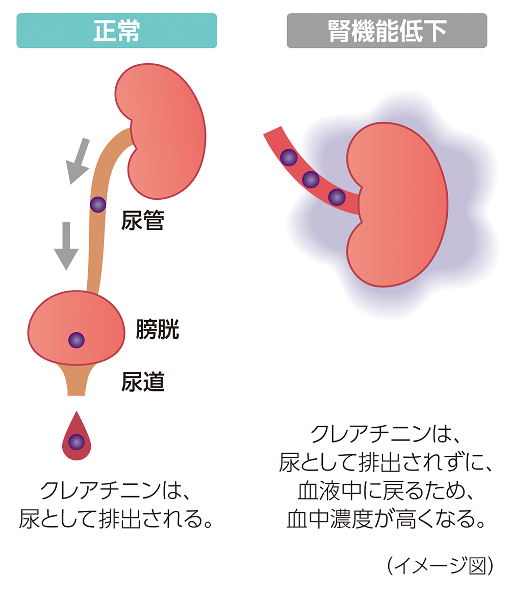 イメージ図：正常状態と腎機能低下状態