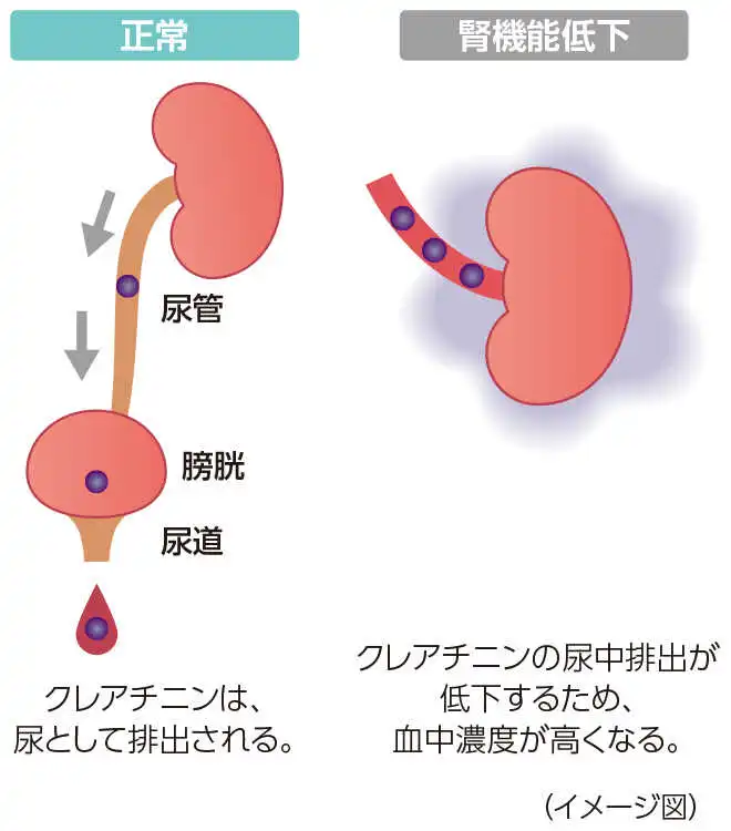 イメージ図：正常状態と腎機能低下状態